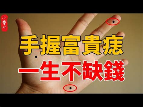 女右手掌突然長痣|女子掌痣突現，運勢將如何？